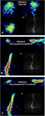 Image-Derived Input Functions for Quantification of A1 Adenosine Receptors Availability in Mice Brains Using PET and [18F]CPFPX
